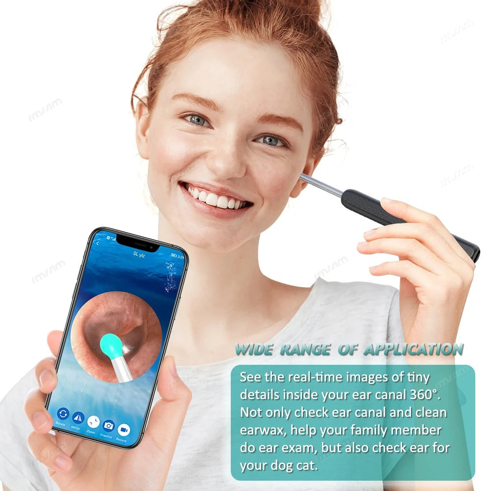 Smart Visual Ear Wax Cleaner